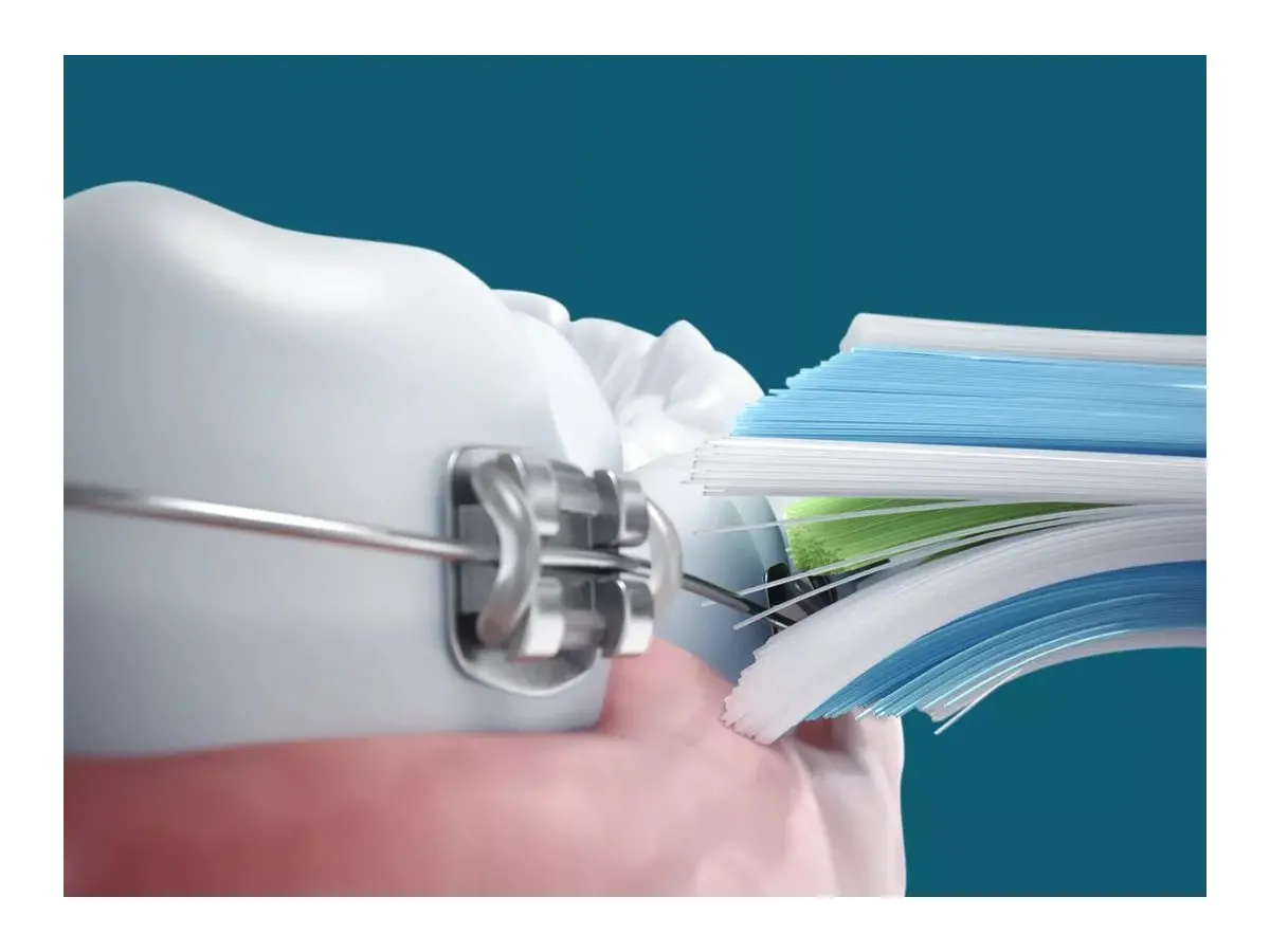 PHILIPS Sonicare Четка за зъби с акумулаторна батерия HX7111/01 2 режима за четкане 1 степен на интензивност черна - image 2